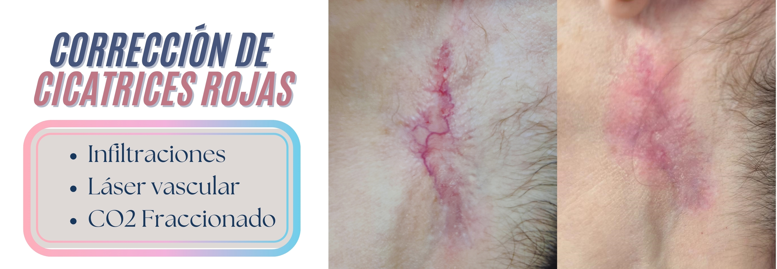 Dermabia