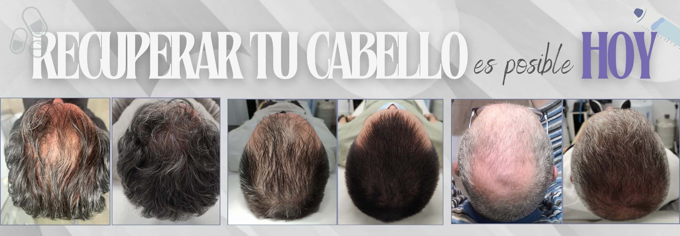 consulta online dermatológica