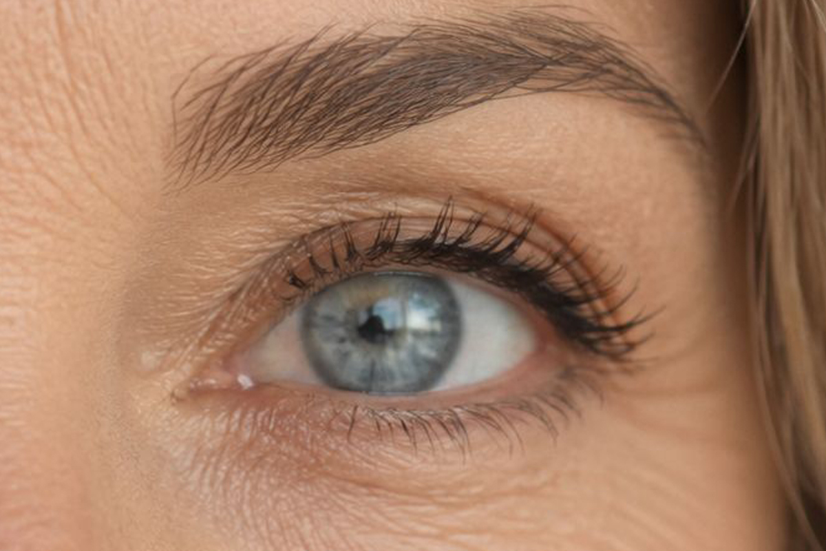Resultado del tratamiento periocular Mirada 360 Pro - mirada luminosa y rejuvenecida