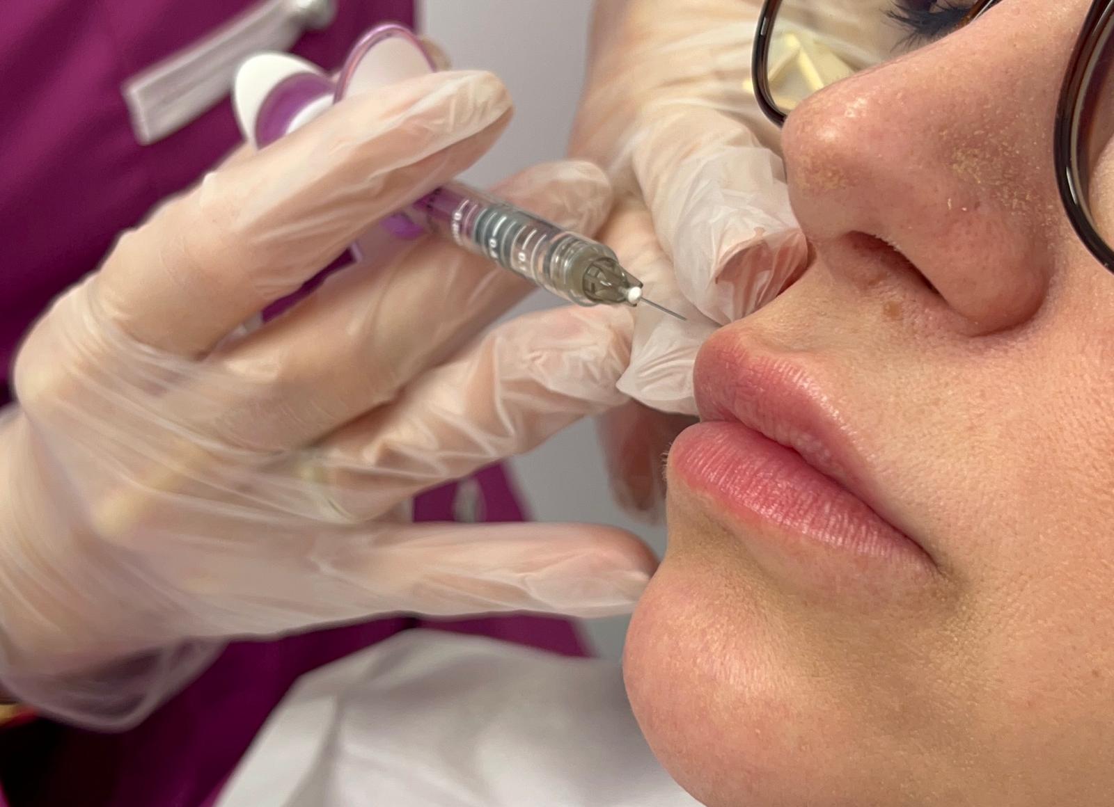 TERAPIA FOTOBIODINMICA EN REJUVENECIMIENTO FACIAL