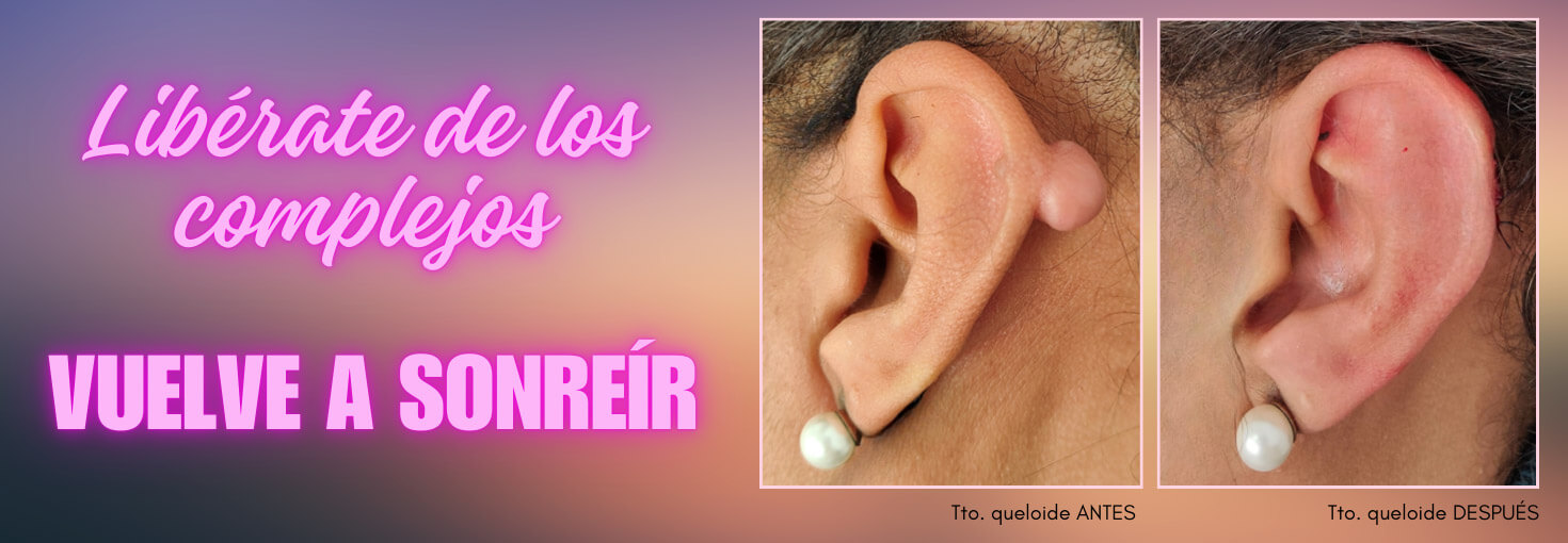 consulta online dermatológica